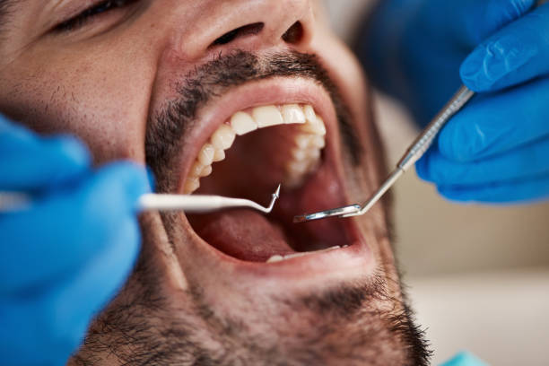 Best Emergency Broken Tooth Repair in Saks, AL