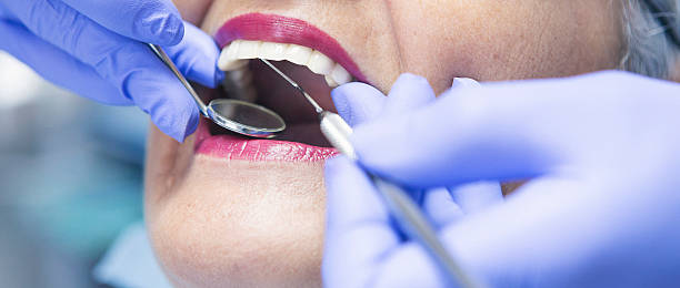 Best Emergency Tooth Extraction in Saks, AL